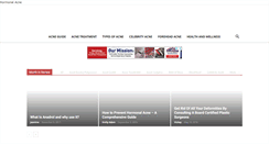 Desktop Screenshot of hormonalacne.net